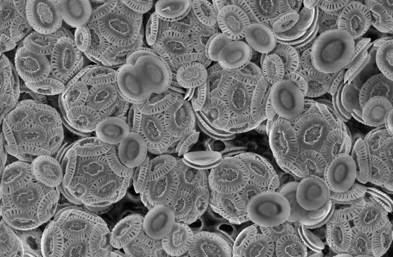 Diatoms- a type of plankton