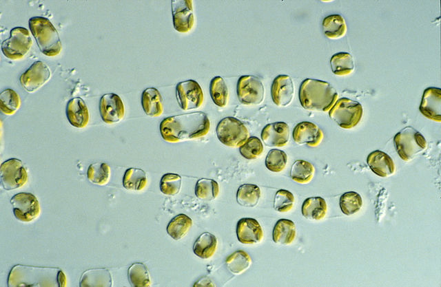 Diatoms- a type of plankton