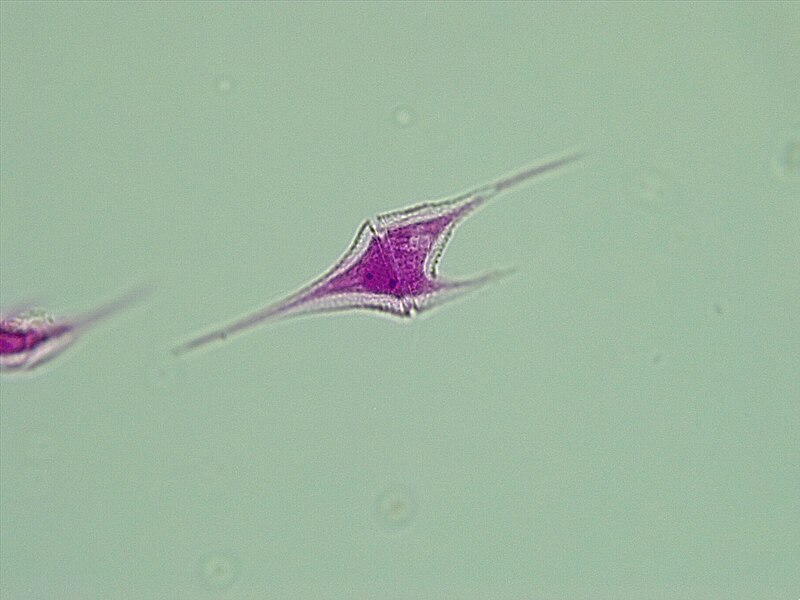 Diatoms- a type of plankton